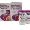 botox treatment