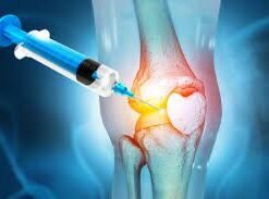 Buy Viscosupplementation Knee Injection Online